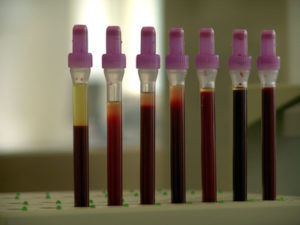 Kleine Blutprobe-Etiketten bedrucken